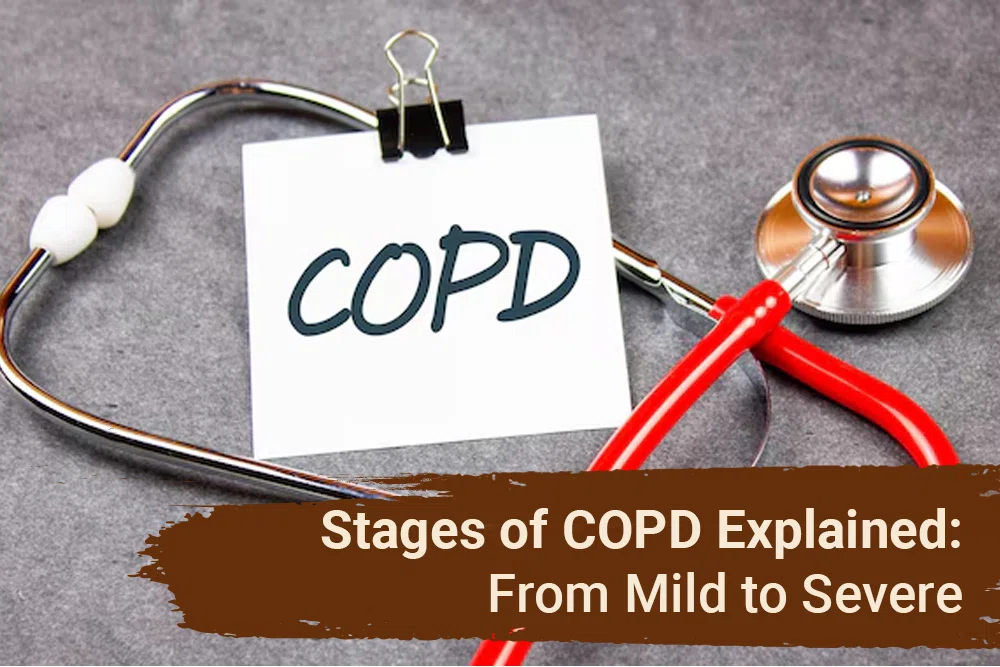 Stages of COPD Explained: From Mild to Severe